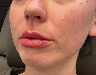 Skindale Medspa before & after